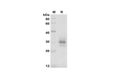 SDS-PAGE analysis of Mouse FLT3LG proteins, 2 μg/lane of Recombinant Mouse FLT3LG proteins was resolved with SDS-PAGE under reducing conditions, showing bands at 28-35 kDa.