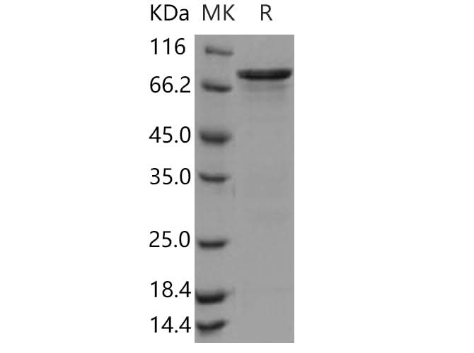 Recombinant Human CHK1/CHEK1 Protein (GST Tag) - ABMIUM
