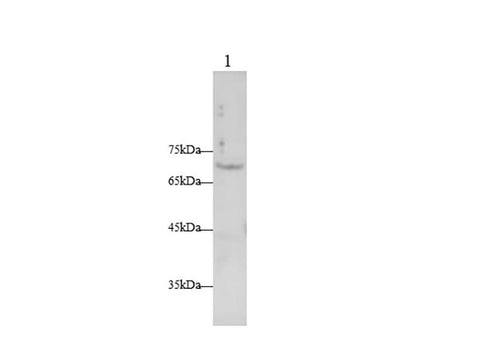 Anti-Human TNFRSF21 Antibody - ABMIUM
