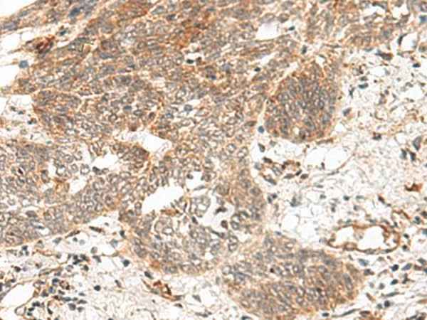 Anti-Human/Mouse/Rat GRASP Antibody