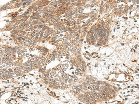 Anti-Human/Mouse/Rat GRASP Antibody - ABMIUM
