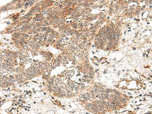Anti-Human/Mouse/Rat GRASP Antibody - ABMIUM