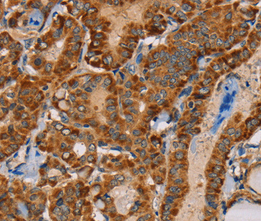 Anti-Human/Mouse MBNL3 Antibody - ABMIUM
