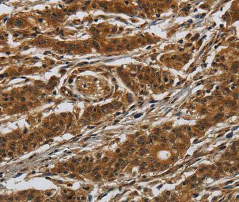 Anti-Human GATA5 Antibody