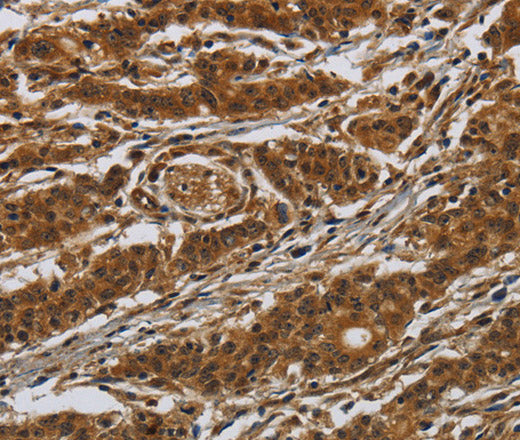 Anti-Human GATA5 Antibody - ABMIUM