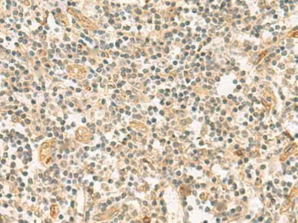Anti-Human/Mouse HHIPL2 Antibody