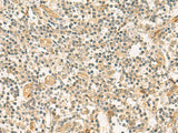 Immunohistochemistry of paraffin-embedded Human tonsil tissue using HHIPL2 Polyclonal Antibody at dilution of 1:55(×200)