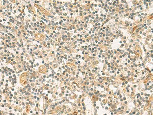Anti-Human/Mouse HHIPL2 Antibody