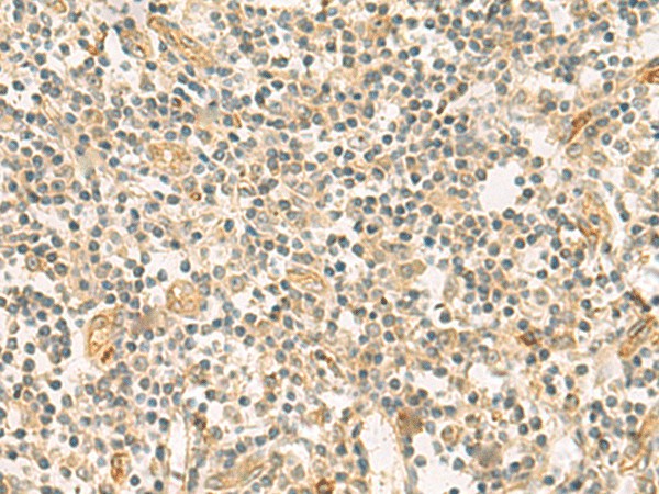 Immunohistochemistry of paraffin-embedded Human tonsil tissue using HHIPL2 Polyclonal Antibody at dilution of 1:55(×200)