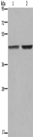 Anti-Human/Mouse GABPB2 Antibody - ABMIUM