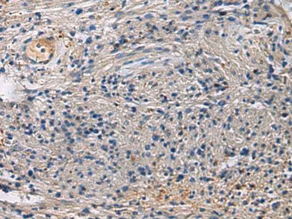 Anti-Human/Mouse/Rat SLC30A3 Antibody