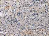 Immunohistochemistry of paraffin-embedded Human brain tissue using SLC30A3 Polyclonal Antibody at dilution of 1:55(×200)