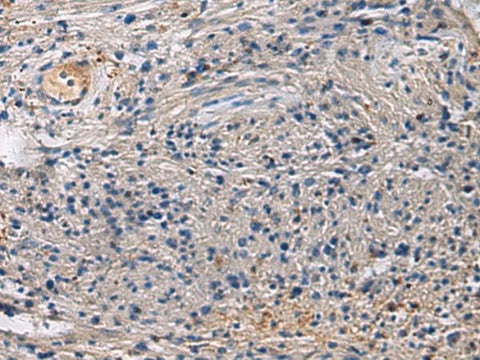 Immunohistochemistry of paraffin-embedded Human brain tissue using SLC30A3 Polyclonal Antibody at dilution of 1:55(×200)