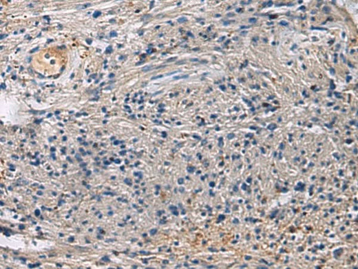 Immunohistochemistry of paraffin-embedded Human brain tissue using SLC30A3 Polyclonal Antibody at dilution of 1:55(×200)