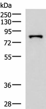 Western blot analysis of HepG2 cell lysate using PRPF3 Polyclonal Antibody at dilution of 1:2000