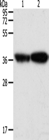 Anti-Human/Mouse/Rat TPM2 Antibody - ABMIUM