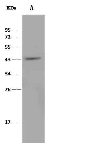 Anti-Human TNFRSF10D Antibody [B256] - ABMIUM