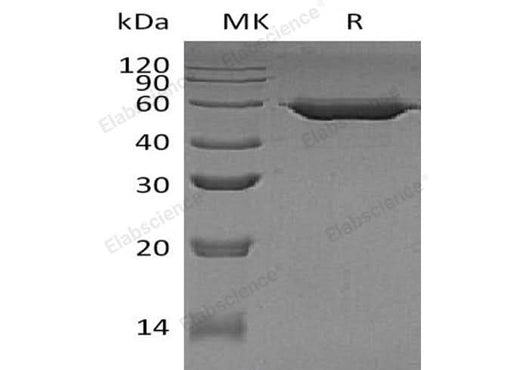 Recombinant Human beta Amylase/AMY2 Protein (His Tag) - ABMIUM
