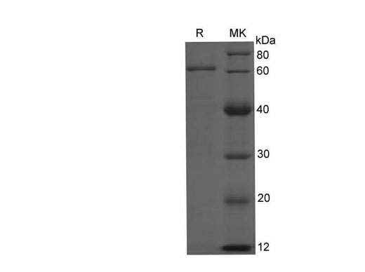 SDS-PAGE analysis of Annexin V-EGFP proteins, 2 μg/lane of Recombinant Annexin V-EGFP proteins was resolved with SDS-PAGE under reducing conditions, showing bands at 62-70 kDa.
