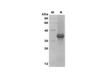 SDS-PAGE analysis of Human IL-33 proteins, 2 μg/lane of Recombinant Human IL-33 proteins was resolved with SDS-PAGE under reducing conditions, showing bands at 33 kDa.