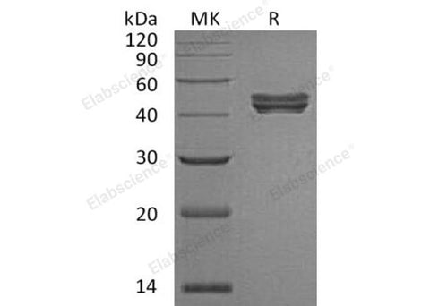 Recombinant Human Sialidase-1/NEU-1 Protein (His Tag) - ABMIUM