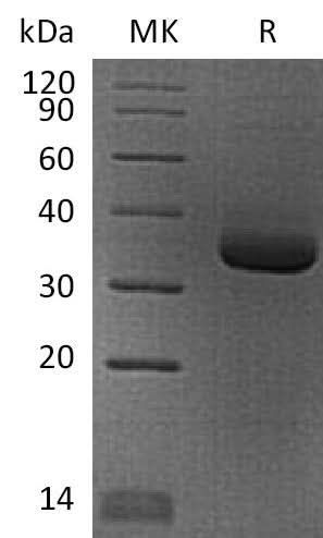 Recombinant Human Angiopoietin-Related Protein 4/ANGPTL4 (N-6His) - ABMIUM