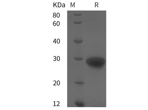 SDS-PAGE analysis of Human TIMP-1 proteins, 2 μg/lane of Recombinant Human TIMP-1 proteins was resolved with SDS-PAGE under reducing conditions, showing bands at 30 kDa.