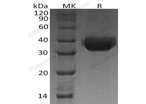 Recombinant Human Protein δ Homolog 1/DLK1 Protein (His Tag) - ABMIUM