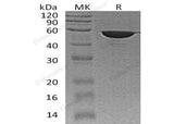 Recombinant Human FKBP4 Protein (His Tag) - ABMIUM
