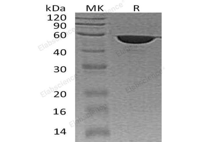 Recombinant Human FKBP4 Protein (His Tag) - ABMIUM