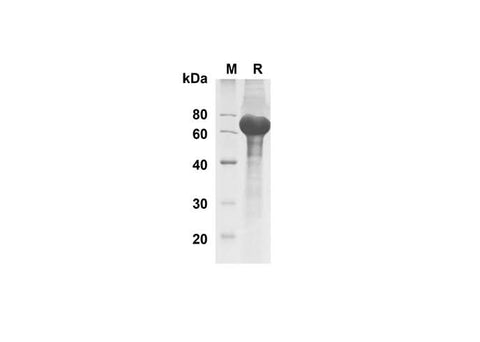SDS-PAGE analysis of Human DLL1 proteins , 2 μg/lane of Recombinant Human DLL1 proteins was resolved with SDS-PAGE under reducing conditions , showing bands at 70 kDa.