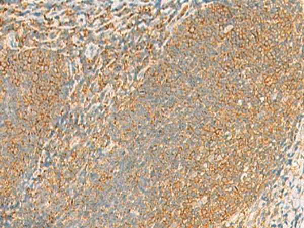 Anti-Human/Mouse/Rat GRIA4 Antibody