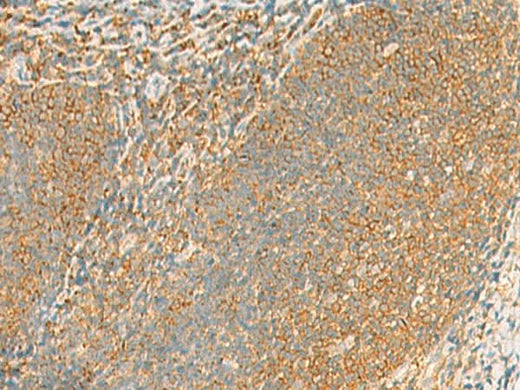 Immunohistochemistry of paraffin-embedded Human tonsil tissue using GRIA4 Polyclonal Antibody at dilution of 1:60(×200)