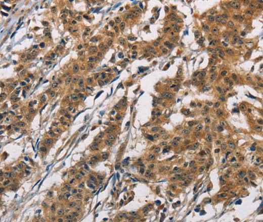 Anti-Human/Mouse/Rat ATP2C1 Antibody