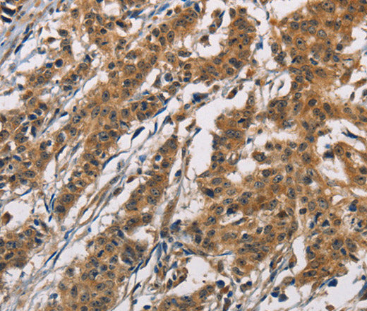 Anti-Human/Mouse/Rat ATP2C1 Antibody - ABMIUM