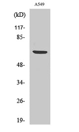 Western Blot analysis of A549 cells using Phospho-p70 S6 kinase alpha (Ser447) Polyclonal Antibody at dilution of 1:1000