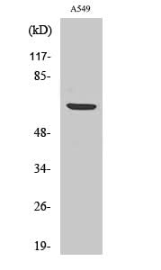 Western Blot analysis of A549 cells using Phospho-p70 S6 kinase alpha (Ser447) Polyclonal Antibody at dilution of 1:1000