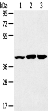 Anti-Human/Mouse/Rat JNK2 Antibody - ABMIUM