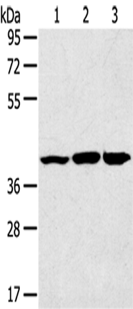 Anti-Human/Mouse/Rat JNK2 Antibody - ABMIUM