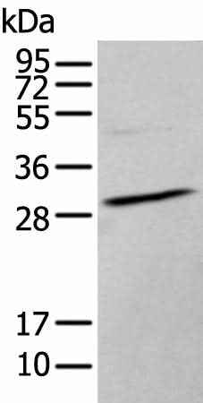 Anti-Human/Mouse HOXC9 Antibody
