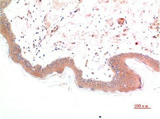 Immunohistochemistry of paraffin-embedded Human skin tissue using Phospho-SMAD3 (Ser425) Monoclonal Antibody at dilution of 1:200