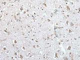 Immunohistochemistry of paraffin-embedded Human brain tissue using MCM10 Polyclonal Antibody at dilution of 1:45(×200)