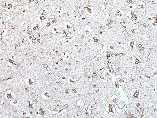 Immunohistochemistry of paraffin-embedded Human brain tissue using MCM10 Polyclonal Antibody at dilution of 1:45(×200)
