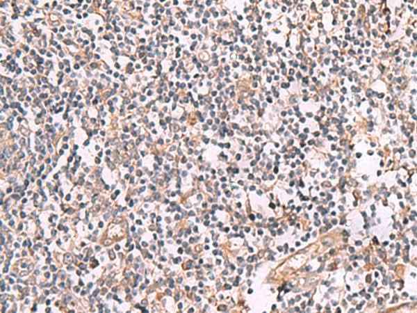Anti-Human/Mouse/Rat SLC12A5 Antibody