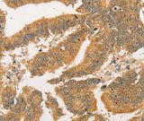 Anti-Human BCL2L14 Antibody - ABMIUM
