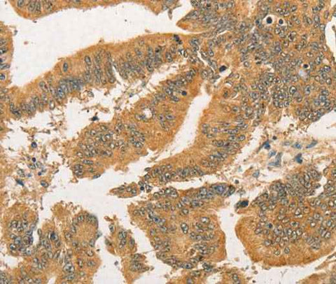 Anti-Human BCL2L14 Antibody
