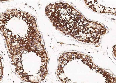 Anti-Human SRPK1 Antibody [A973] - ABMIUM
