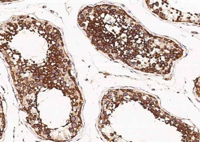 Anti-Human SRPK1 Antibody [A973] - ABMIUM