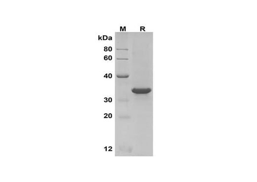 SDS-PAGE analysis of Human PD1 proteins, 2 μg/lane of Recombinant Human PD1 proteins was resolved with SDS-PAGE under reducing conditions, showing bands at 35 kDa.