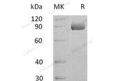 Recombinant Human SEMA4B Protein (His Tag) - ABMIUM